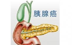 美國(guó)冷泉港實(shí)驗(yàn)室科學(xué)家利用胰腺癌的成癮性來(lái)開(kāi)發(fā)新型抗癌療法