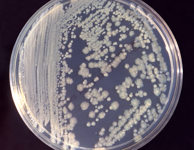 ISS微生物應(yīng)該避免威脅宇航員的健康