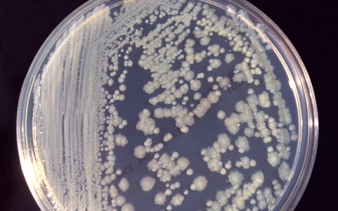 ISS微生物應(yīng)該避免威脅宇航員的健康