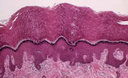 認識你的Interstitium 一個新發(fā)現(xiàn)的'器官'