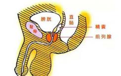 脫發(fā)和擴(kuò)大前列腺的藥物可能導(dǎo)致性欲減退