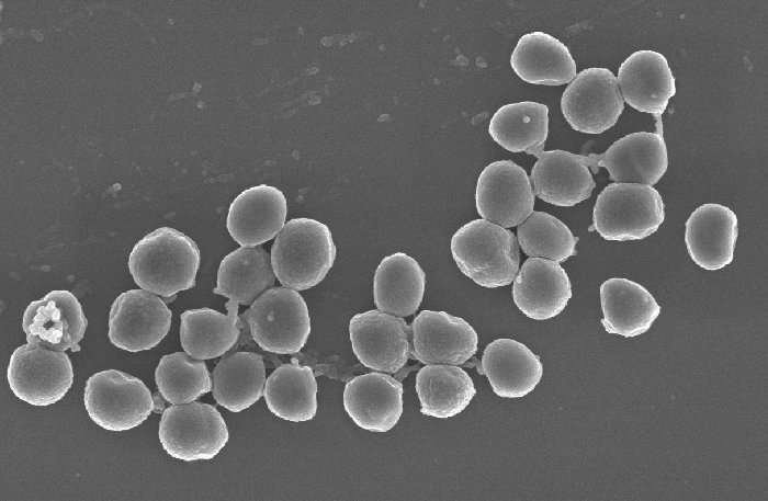 科學家發(fā)現(xiàn)抗擊抗生素的潛在武器