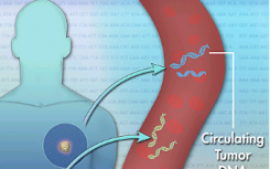 循環(huán)腫瘤DNA新一代癌癥生物標志物