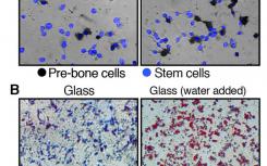 干細(xì)胞中的水量可以決定其作為脂肪或骨骼的命運