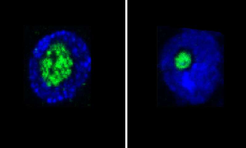 Nucleolus是預(yù)期壽命的預(yù)測因子