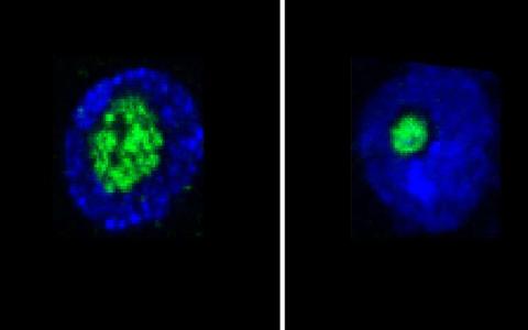 Nucleolus是預(yù)期壽命的預(yù)測(cè)因子