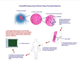 用DNA測(cè)序監(jiān)測(cè)器官移植排斥反應(yīng)