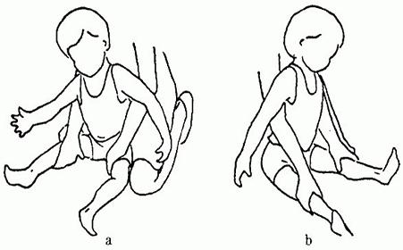 腦癱患者患抑郁癥和焦慮癥的風(fēng)險(xiǎn)較高