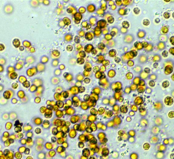 Symbiodinium kawagutii。 圖片來(lái)源：Scott R. Santos / Auburn大學(xué)。