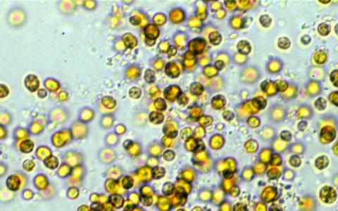 Dinoflagellate Genome令研究人員感到驚訝