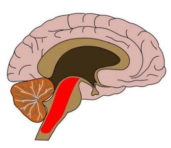 MRI技術(shù)在橄欖球運動員中顯示出獨特的腦震蕩特征