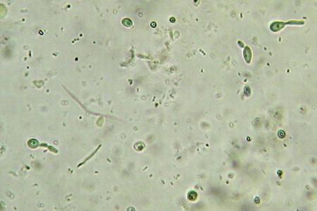 比較真菌分泌物以揭示碳化合物降解途徑