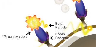 諾華制藥以21億美元收購Endocyte 擴大RLT治療前列腺癌的渠道