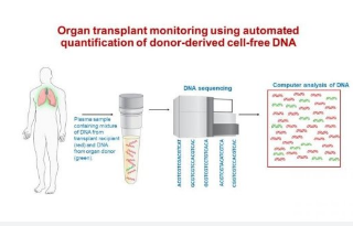 驗血有望早期發(fā)現(xiàn)嚴(yán)重的肺移植排斥反應(yīng)