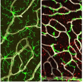 有缺陷的分子主開關(guān)可能有助于AMD