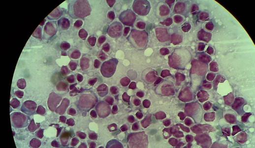 皰疹病毒和腫瘤進(jìn)化為學(xué)習(xí)如何操縱相同的古老RNA