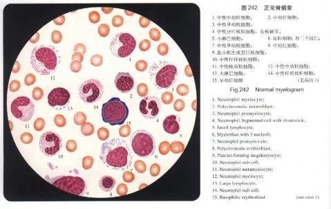 新的細(xì)胞圖譜可以更深入地了解致盲疾病