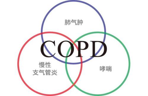 COPD抗炎策略中靶向炎癥介質(zhì)的小分子藥物