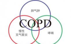 COPD抗炎策略中靶向炎癥介質(zhì)的小分子藥物