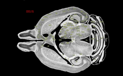 科學(xué)家首次構(gòu)建出人類和小鼠大腦免疫系統(tǒng)圖譜