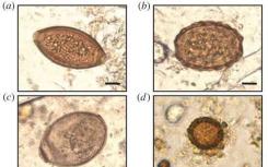 來(lái)自中世紀(jì)廁所的寄生蟲(chóng)揭開(kāi)了人類(lèi)歷史的秘密