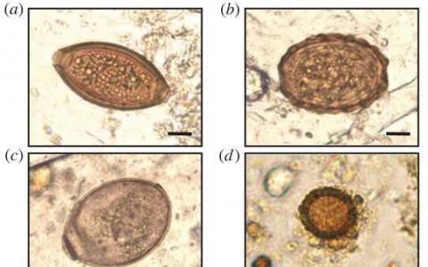 來自中世紀(jì)廁所的寄生蟲揭開了人類歷史的秘密