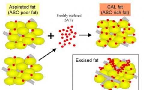 與較胖脂肪細胞相關(guān)的低銅水平