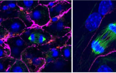 用于分割染色體的3-D細(xì)胞環(huán)境關(guān)鍵發(fā)現(xiàn)可以解釋癌癥的標(biāo)志
