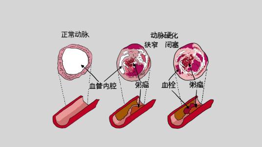 研究重點(diǎn)需要使人口水平的遺傳數(shù)據(jù)多樣化以便更好地預(yù)測(cè)疾病