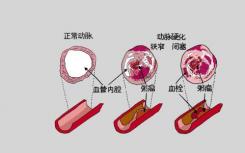 研究重點需要使人口水平的遺傳數(shù)據(jù)多樣化以便更好地預測疾病