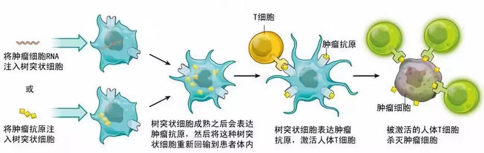 鑒定抗癌免疫與腸道微生物組之間的因果關(guān)系