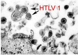 致癌病毒HTLV-1改變DNA環(huán)以“影響成千上萬的基因”