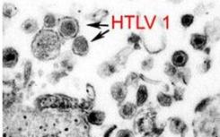 致癌病毒HTLV-1改變DNA環(huán)以“影響成千上萬的基因”