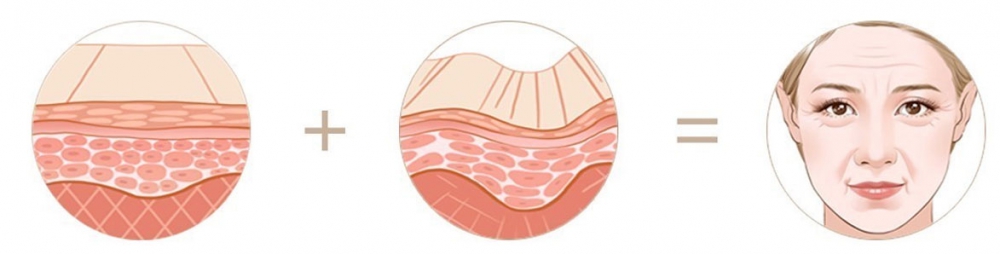 研究表明人類和其他哺乳動物之間的關(guān)鍵差異在于皮膚深層