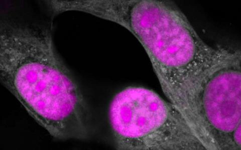 CRISPR遺傳編輯向前邁出了一大步針對(duì)RNA