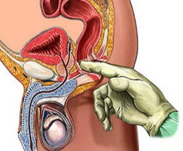 用多組學方法改善結(jié)腸癌治療