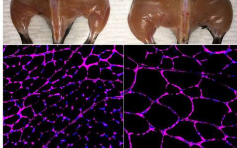 科學(xué)家修改CRISPR以表觀遺傳學(xué)治療糖尿病，腎臟疾病，肌肉萎縮癥