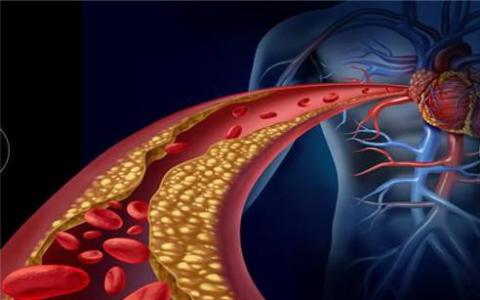 研究可以帶來增加“好”膽固醇的策略