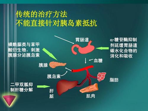 大型研究將罕見的DNA改變與2型糖尿病聯(lián)系起來