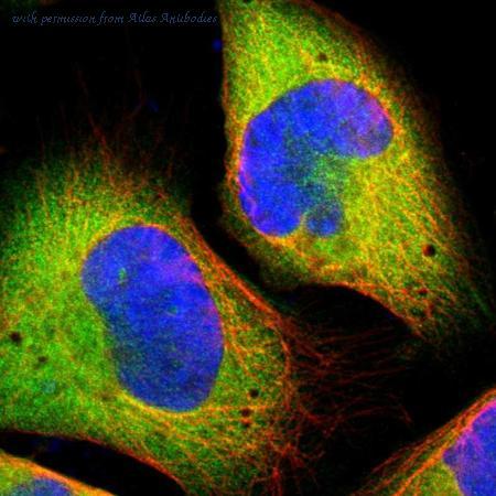 Human Cell Atlas希望揭開隱藏在我們基因中的神秘面紗