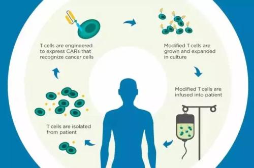 改善針對實體瘤的CAR T免疫療法結(jié)果