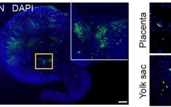 科學(xué)家們擴(kuò)展了干細(xì)胞重新生長任何組織類型的能力