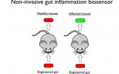 合成生物學(xué)家設(shè)計(jì)炎癥感應(yīng)腸道細(xì)菌