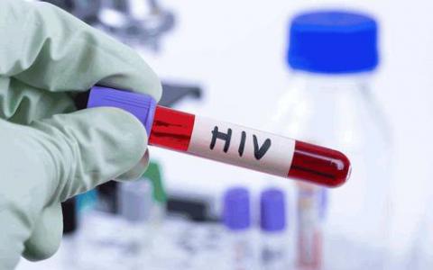 基于GP的HIV檢測具有成本效益 應在地方當局推出