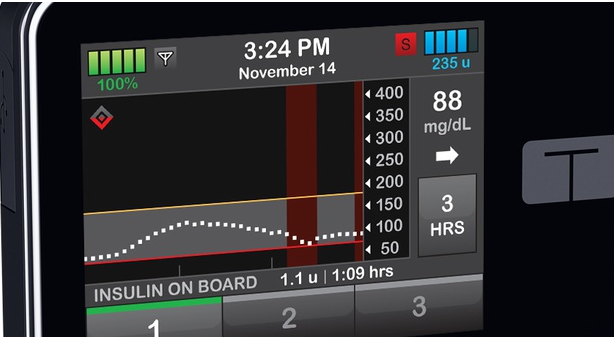Tandem使第一臺可互操作的胰島素泵獲得FDA的好評