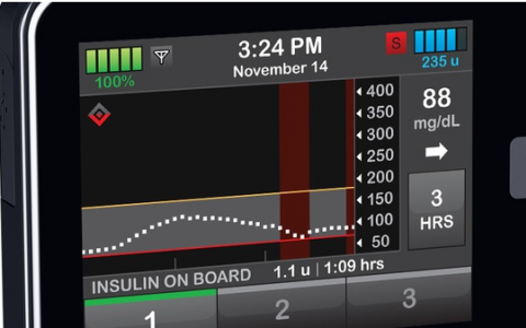 Tandem使第一臺(tái)可互操作的胰島素泵獲得FDA的好評(píng)