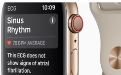 新的Apple Watch添加了FDA批準的ECG應用