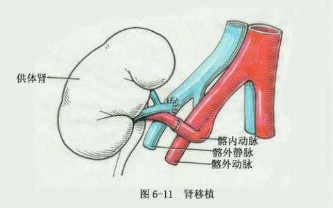 盡管政策改變 早期腎臟移植仍存在差異