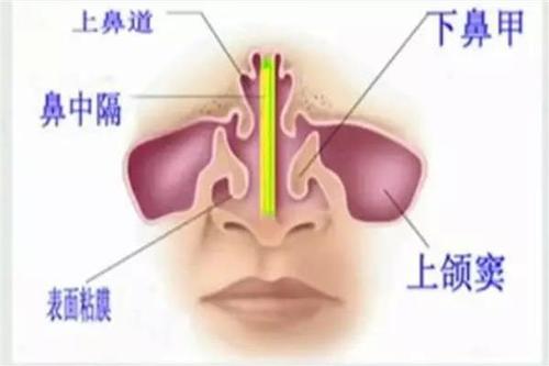 研究小組建議在治療成人鼻竇炎時(shí)共同決策