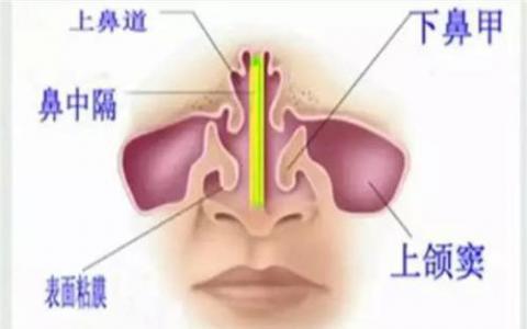 研究小組建議在治療成人鼻竇炎時共同決策